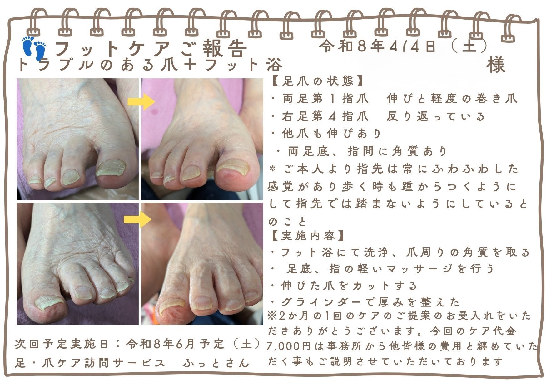 福岡県　高齢者爪切りサービス　口コミ写真