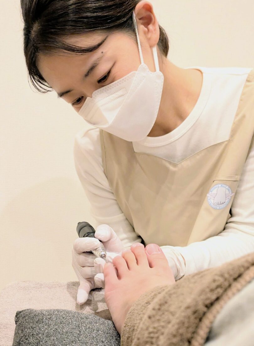 ケア・フレス｜大阪府高槻市・茨木市・枚方市へ出張訪問｜高齢者爪切りサービス・肥厚爪・巻き爪ケア