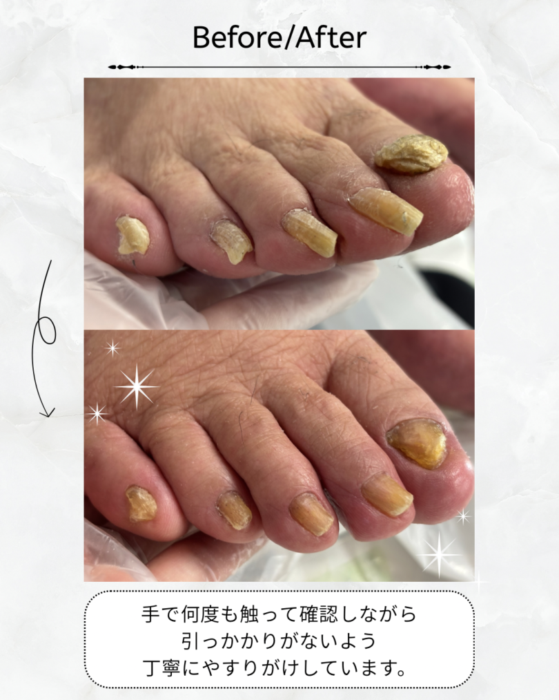群馬県 高崎市 訪問フットケアサロン