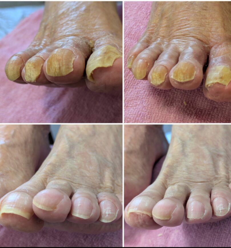 高齢者爪切りサービス　福岡県