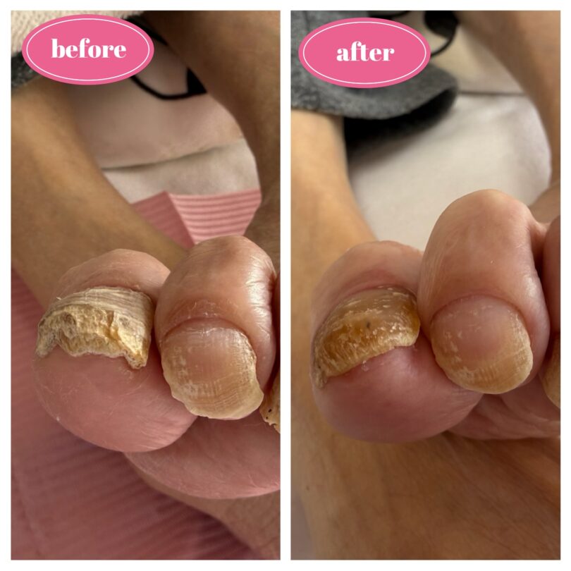 高齢者爪切りサービス　神奈川県